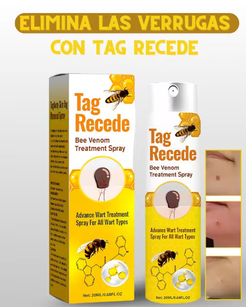 TAG RECEDE, ADIOS A LAS VERRUGAS DE FORMA RAPIDA Y SEGURA